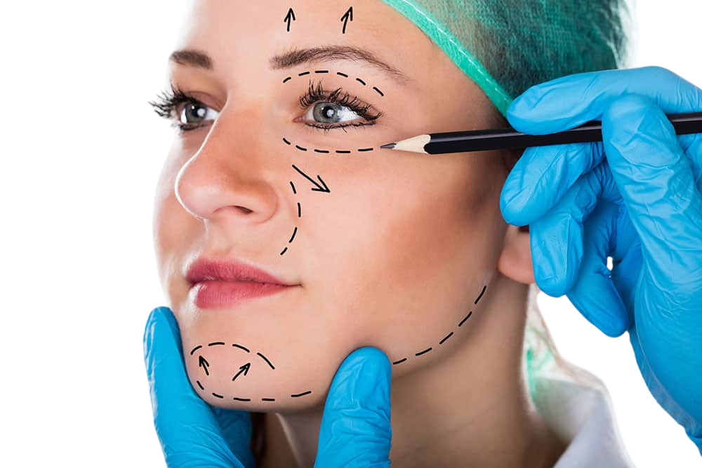 FACE-NECK-LIFT (1)-Photoroom