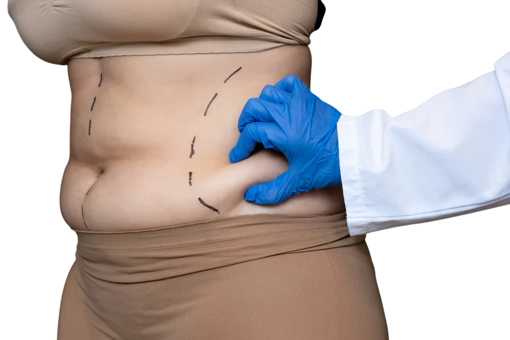 laserliposuctioninturkey-Photoroom